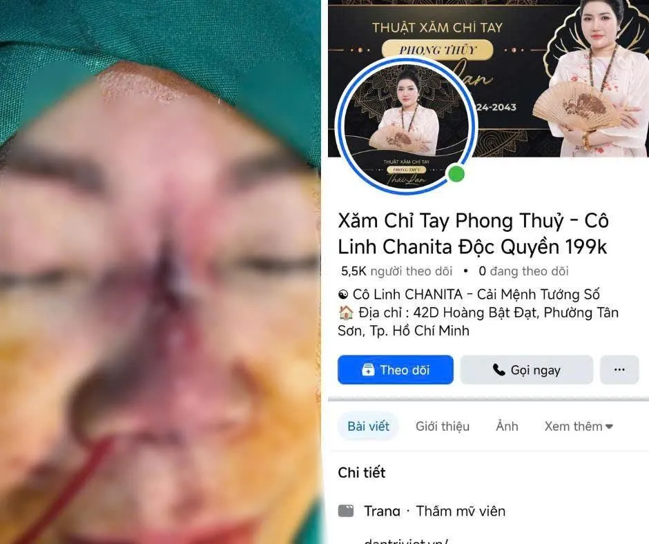 Mũi 